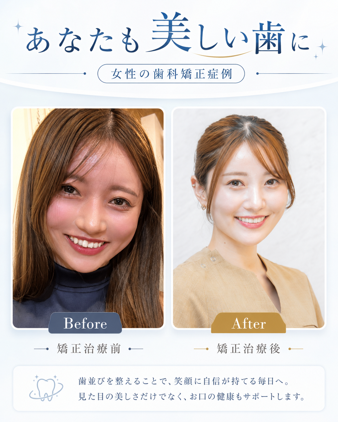 東京銀座NOVA矯正歯科
