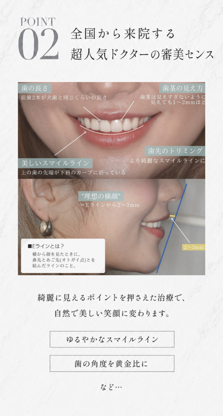 4つの特徴-2