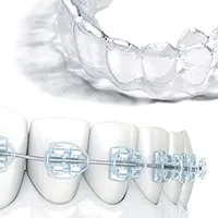 コンビネーション矯正