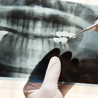 特別集中治療コース