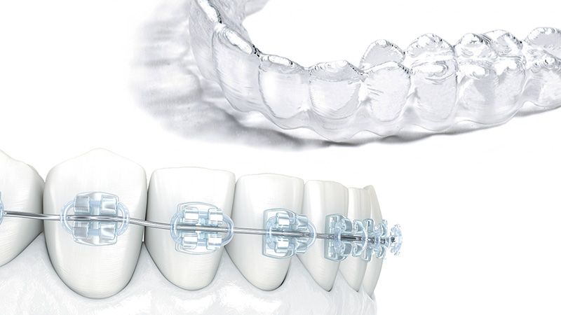 コンビネーション矯正