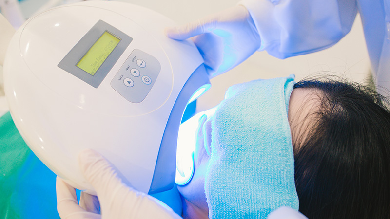 オフィスホワイトニングの施術