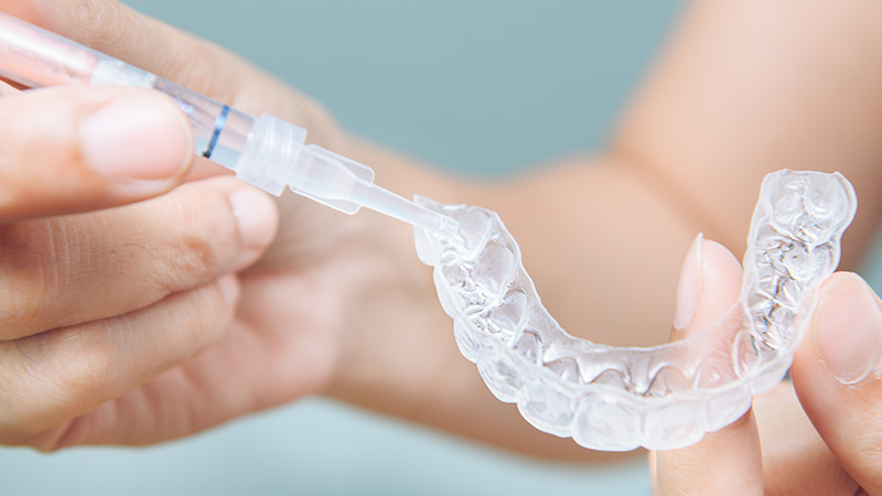 ホームホワイトニングのマウスピース