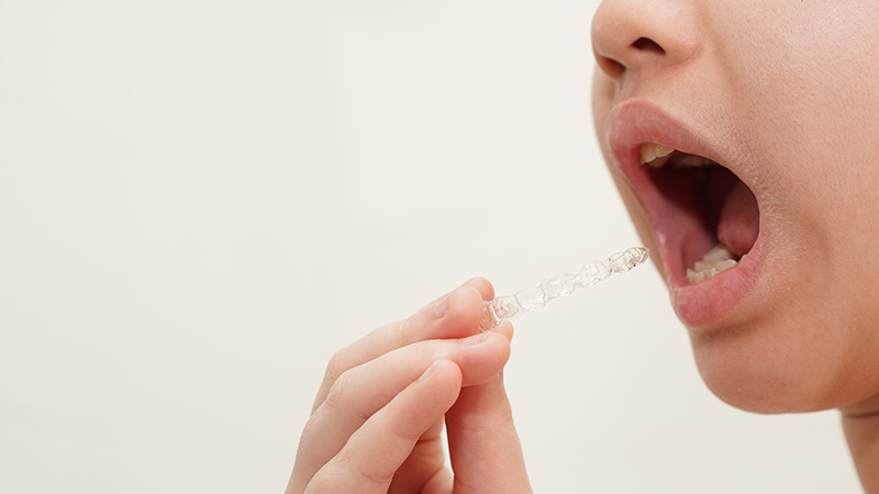 取り外し式の装置で負担を軽減