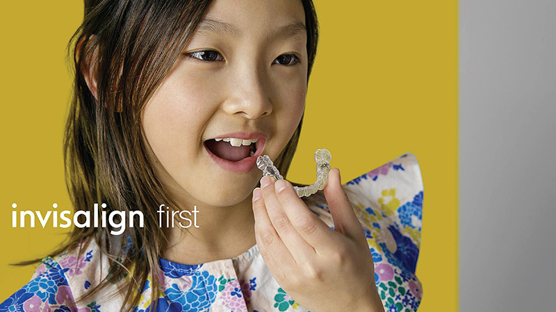 インビザラインファースト