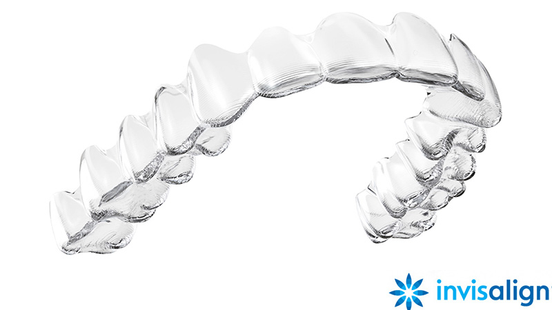 インビザライン（Invisalign）