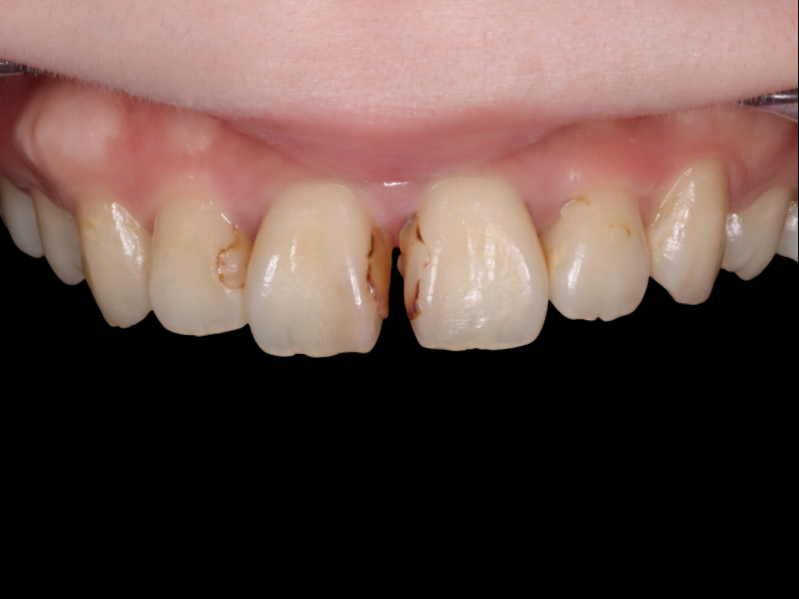 Before