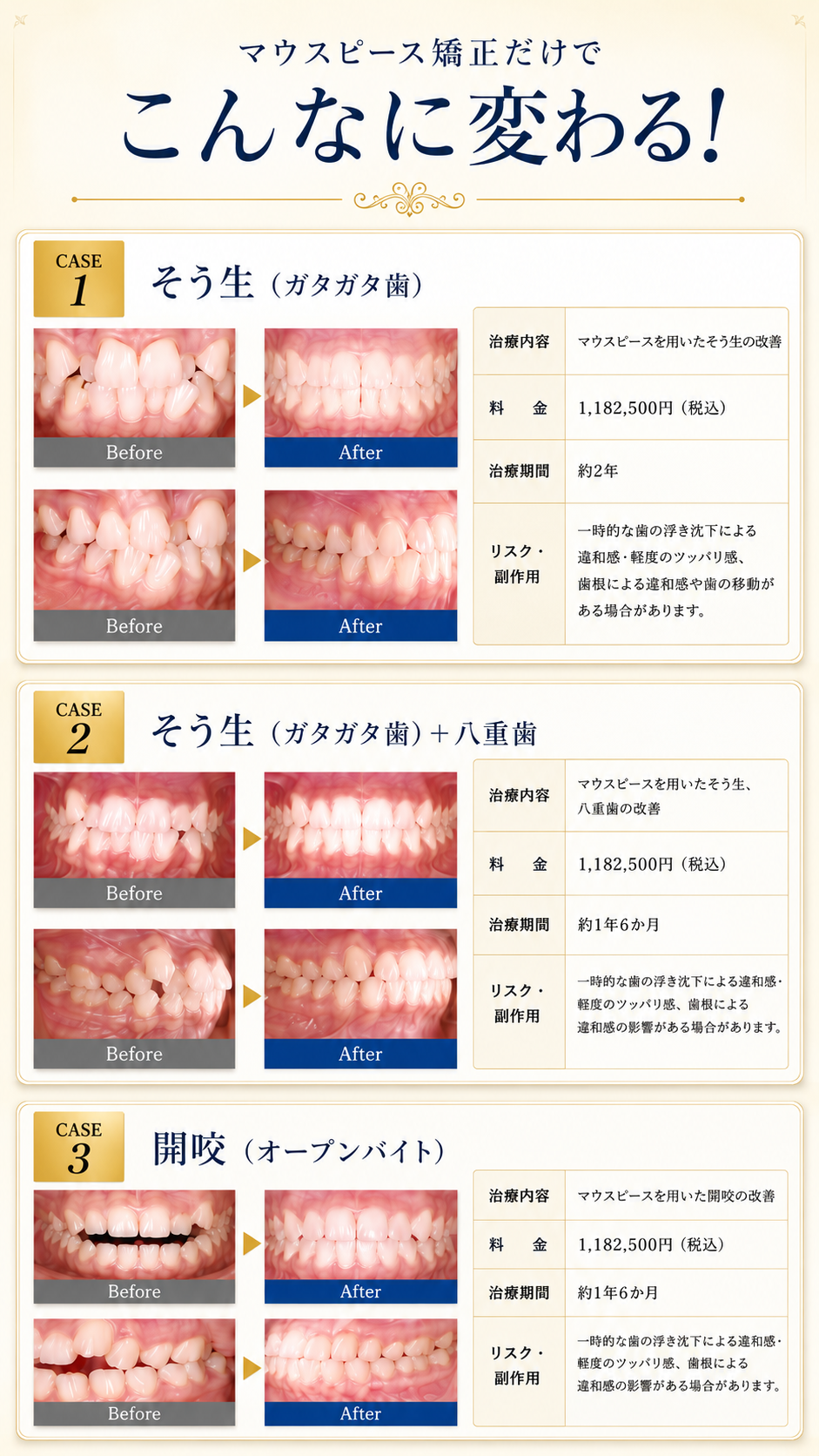 東京銀座NOVA矯正歯科