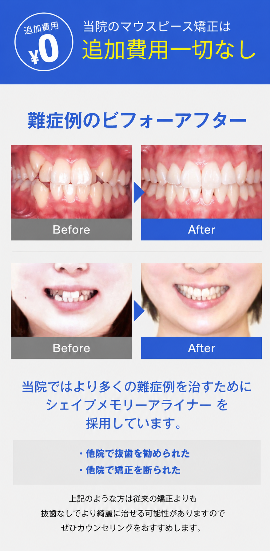 東京銀座NOVA矯正歯科