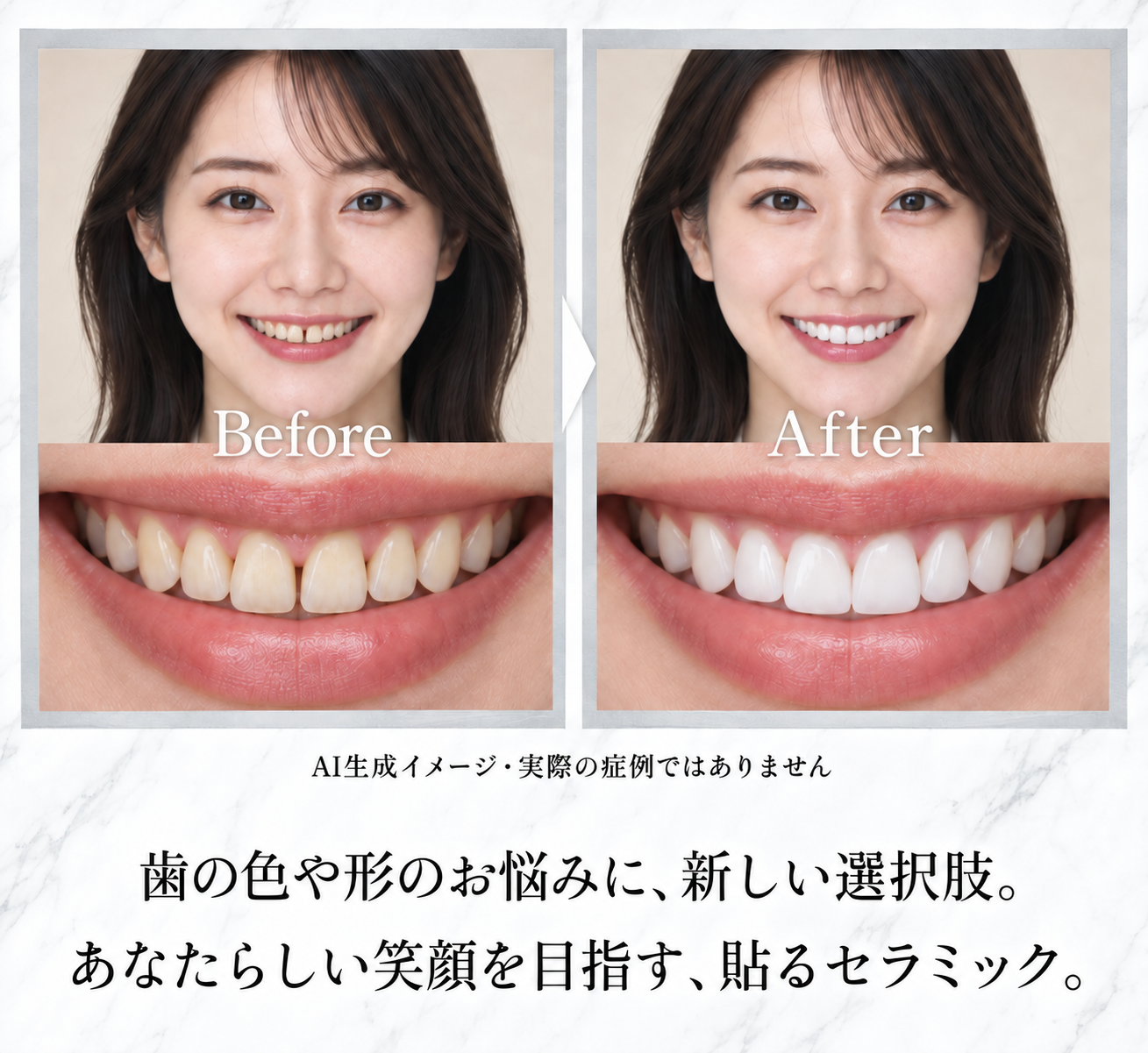 東京銀座NOVA矯正歯科の治療症例紹介