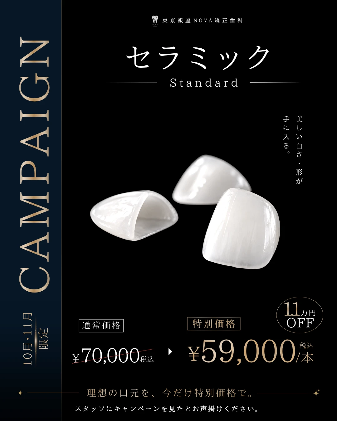 セラミック Standard 1.1万円OFF